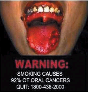 Singapore 2006 Health Effects mouth - oral cancer, diseased organ, gross
